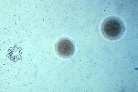 Il mycoplasma pnaumoniae è uno degli indiziati per i focolai di polmoniti in Cina (fonte: NIAID, CC BY-NC-SA 2.0)
