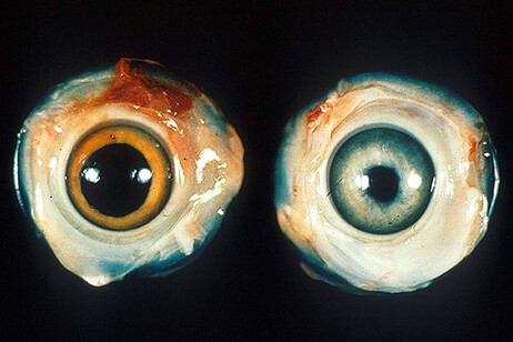Sulla destra, un occhio di pollo sano; sulla sinistra l'occhio di un pollo colpito dalla malattia di Marek (fonte: USDA Agricultural Research Service, da Wikipedia)