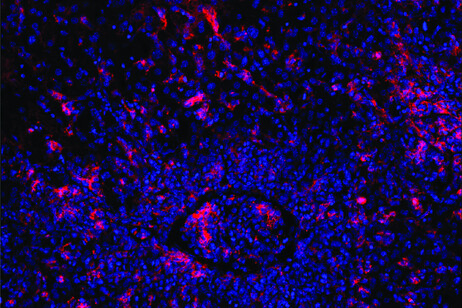 Cellule T malate scatenano un'eccessiva risposta immunitaria, ostruendo un vaso sanguigno (al centro) (fonte: Elijah D. Lowenstein and Xun Li, K. Rajewsky Lab, Max Delbrück Center)
