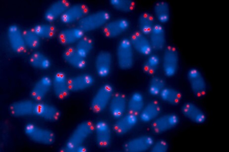 Telomeri visti al microscopio (fonte: Thomas Ried, Center for Cancer Research, National Cancer Institute)