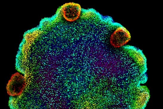 Il nucleo cellulare di un placozoo (fonte: Sebastian R. Najle/Centro de Regulación Genómica)
