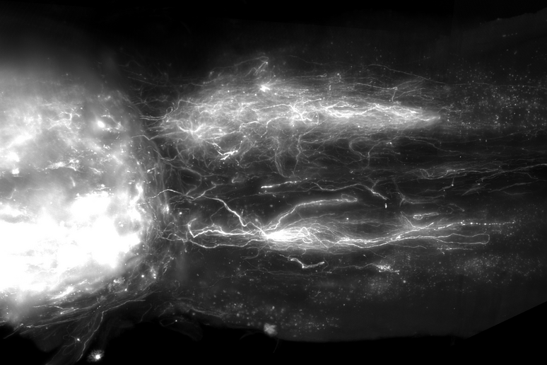 Visualizzazione dei nervi lesionati del midollo spinale in fase di rigenerazione (fonte: EPFL / .Neurorestore) - RIPRODUZIONE RISERVATA